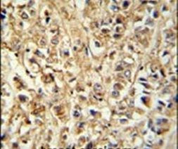 DDX6 Antibody in Immunohistochemistry (IHC)