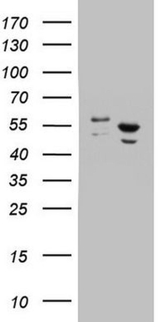 DDX6 Antibody in Western Blot (WB)