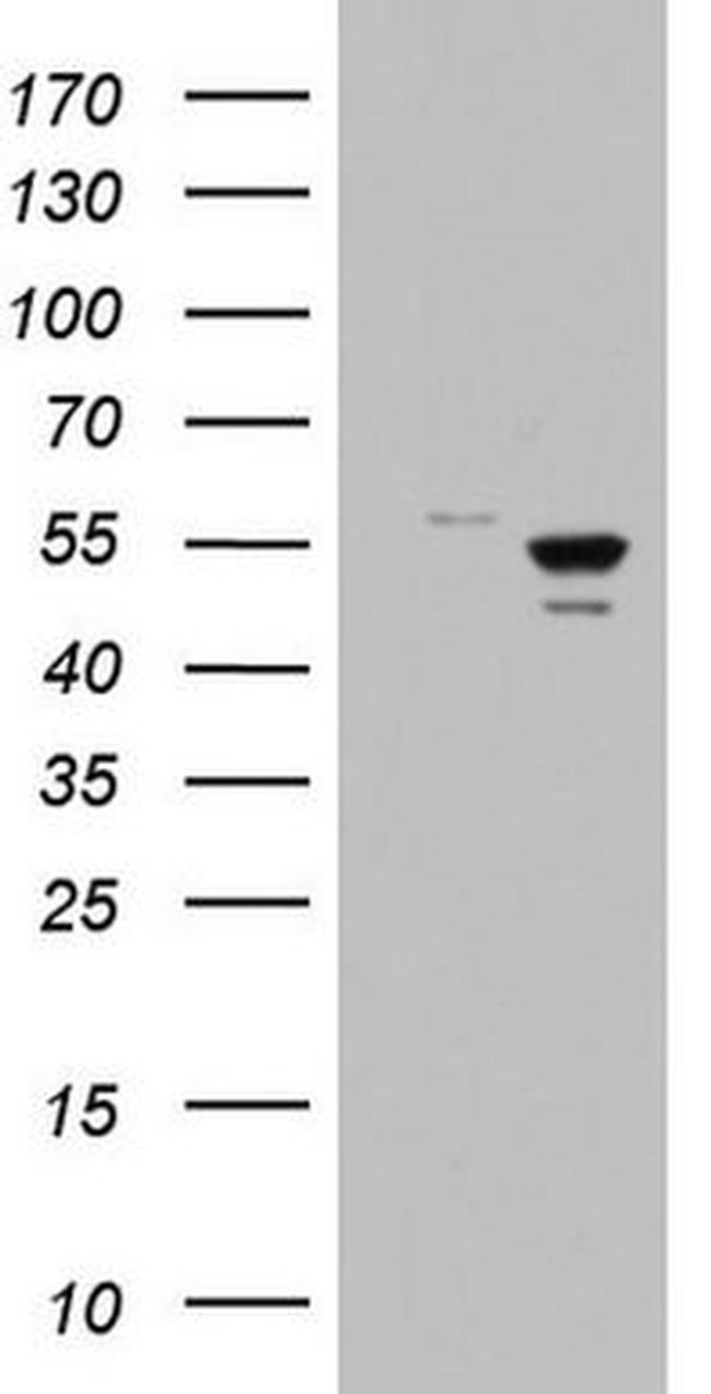 DDX6 Antibody in Western Blot (WB)