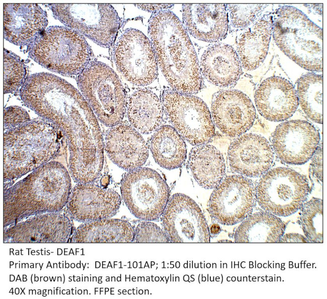 Deformed Epidermal Autoregulatory Factor 1 Antibody in Immunohistochemistry (IHC)