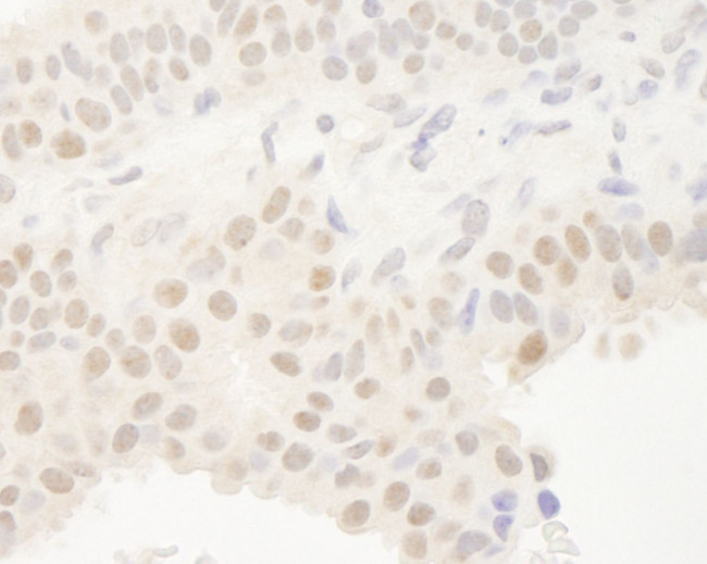 DEC1 Antibody in Immunohistochemistry (IHC)