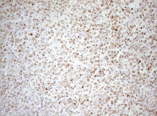 DECR1 Antibody in Immunohistochemistry (Paraffin) (IHC (P))