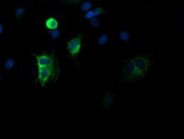 DEF6 Antibody in Immunocytochemistry (ICC/IF)