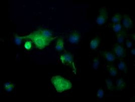 DEF6 Antibody in Immunocytochemistry (ICC/IF)