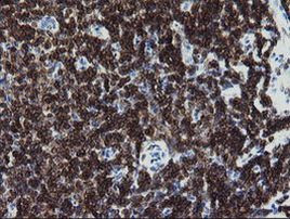 DEF6 Antibody in Immunohistochemistry (Paraffin) (IHC (P))