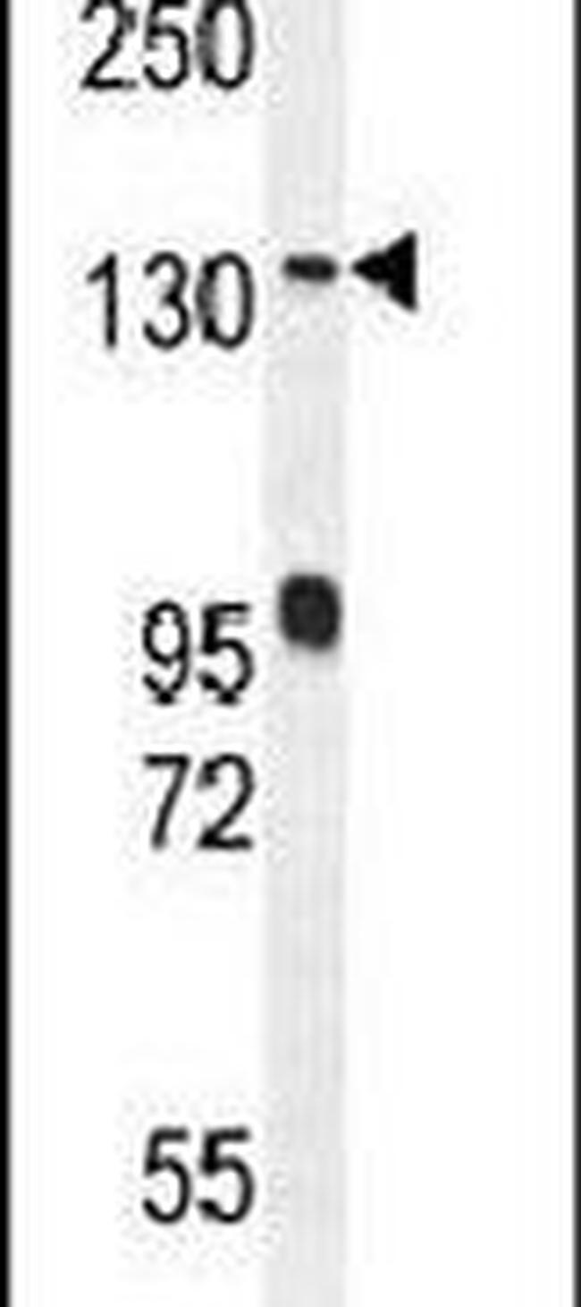 DENND5A Antibody in Western Blot (WB)
