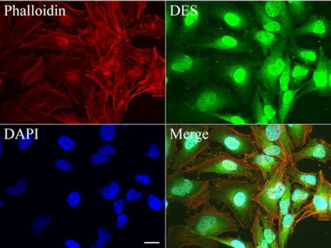 DES Antibody in Immunocytochemistry (ICC/IF)