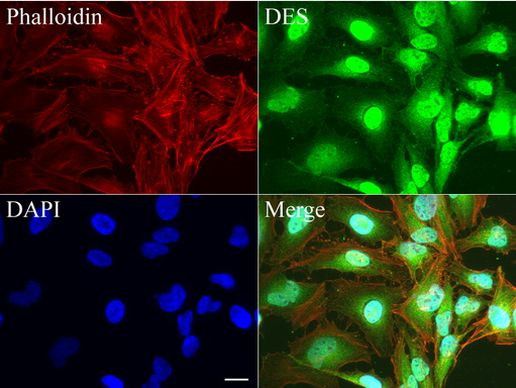 DES Antibody in Immunocytochemistry (ICC/IF)
