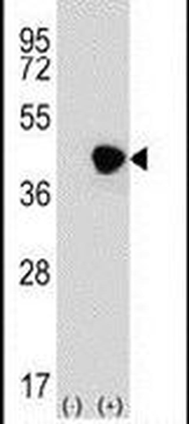 ICAD Antibody in Western Blot (WB)