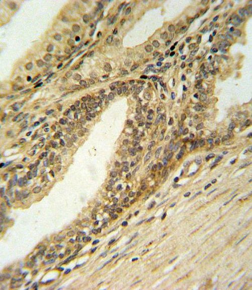 DFFB Antibody in Immunohistochemistry (IHC)