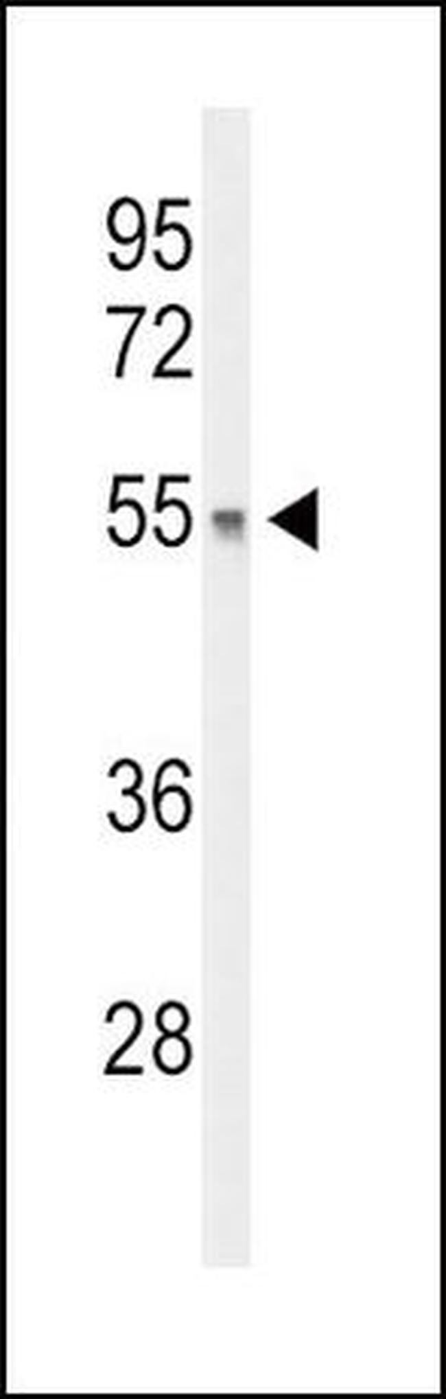 DGCR2 Antibody in Western Blot (WB)
