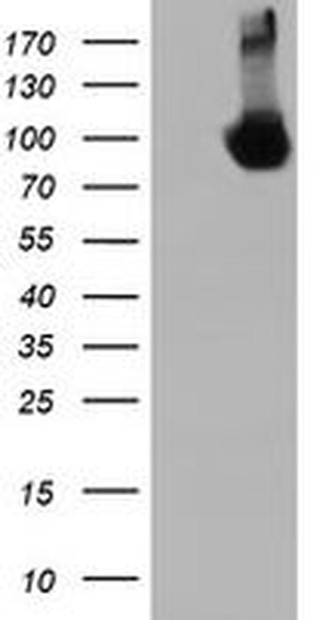 DGKA Antibody in Western Blot (WB)