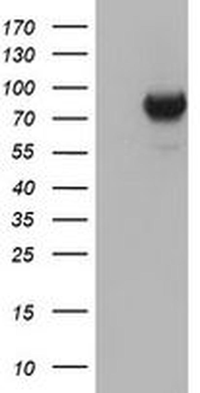 DGKA Antibody in Western Blot (WB)