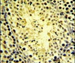 DGKK Antibody in Immunohistochemistry (IHC)