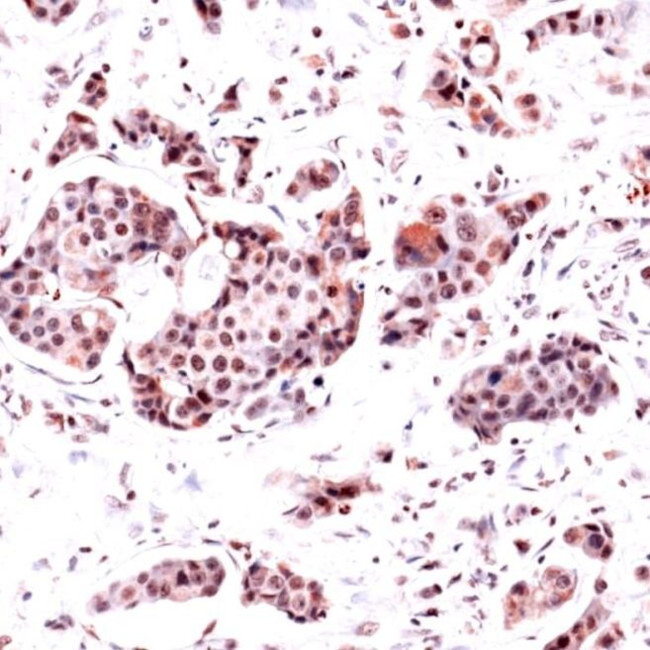 DHFR Antibody in Immunohistochemistry (IHC)