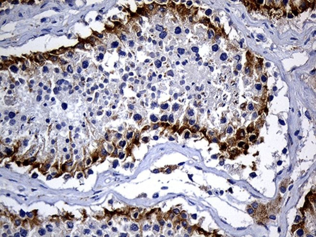 DHRS4L2 Antibody in Immunohistochemistry (Paraffin) (IHC (P))