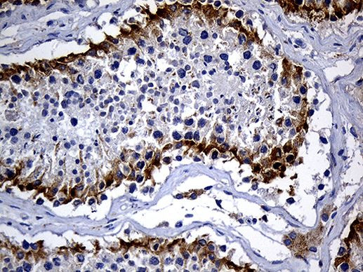DHRS4L2 Antibody in Immunohistochemistry (Paraffin) (IHC (P))