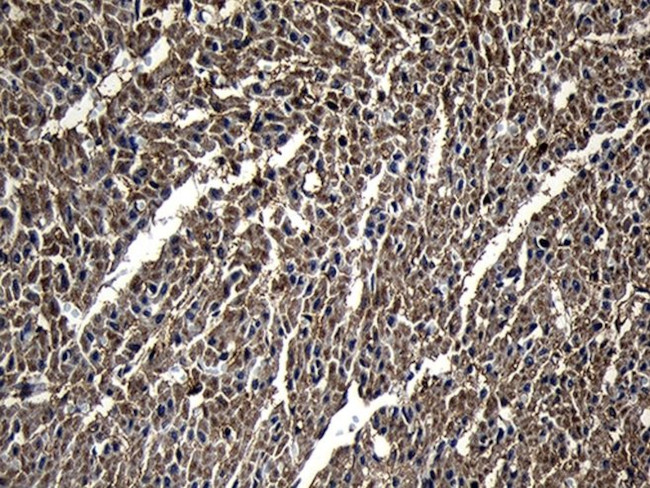 DHRS4L2 Antibody in Immunohistochemistry (Paraffin) (IHC (P))