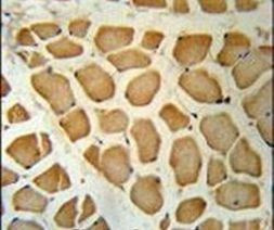 DHRS7 Antibody in Immunohistochemistry (IHC)