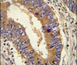 LGP2 Antibody in Immunohistochemistry (IHC)
