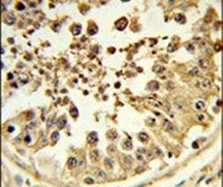 DIAPH2 Antibody in Immunohistochemistry (IHC)