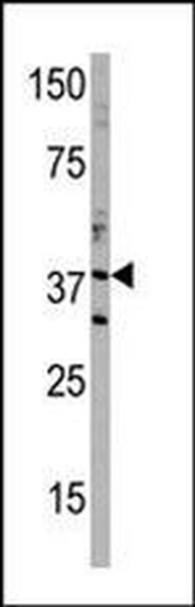 DIMT1 Antibody in Western Blot (WB)