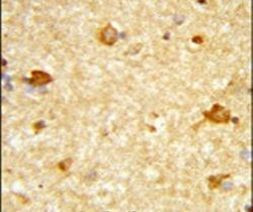 DIRAS1 Antibody in Immunohistochemistry (IHC)
