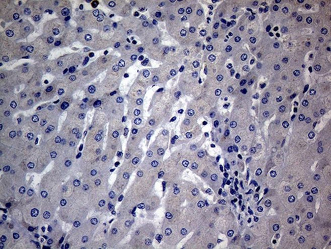 DIRAS2 Antibody in Immunohistochemistry (Paraffin) (IHC (P))