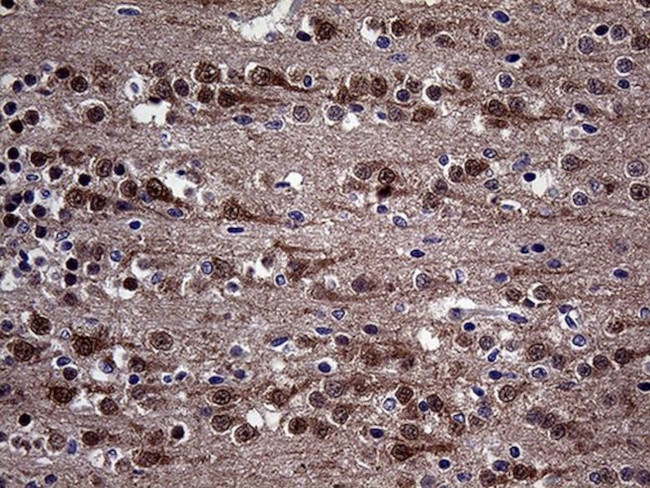 DIRAS2 Antibody in Immunohistochemistry (Paraffin) (IHC (P))