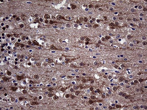 DIRAS2 Antibody in Immunohistochemistry (Paraffin) (IHC (P))