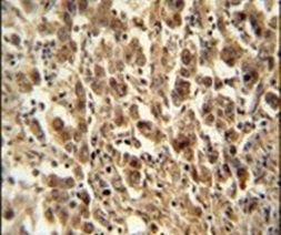 DIS3 Antibody in Immunohistochemistry (IHC)