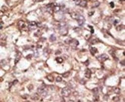 DKK4 Antibody in Immunohistochemistry (IHC)