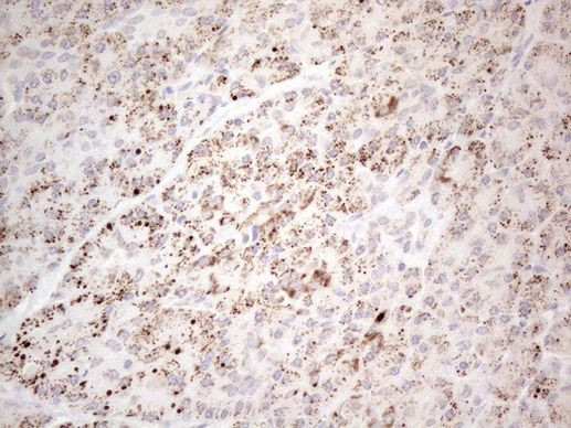 DLX4 Antibody in Immunohistochemistry (Paraffin) (IHC (P))