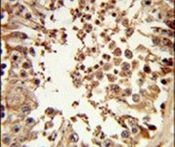 DMC1 Antibody in Immunohistochemistry (IHC)