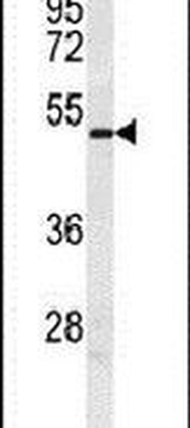 DMRT3 Antibody in Western Blot (WB)