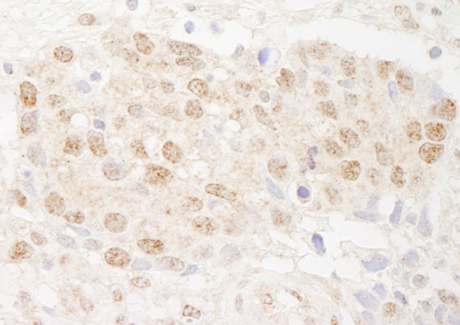 DMWD Antibody in Immunohistochemistry (IHC)