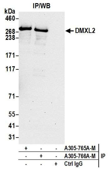 DMXL2 Antibody in Immunoprecipitation (IP)