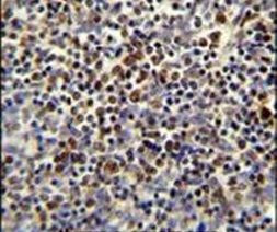 DNA2 Antibody in Immunohistochemistry (IHC)