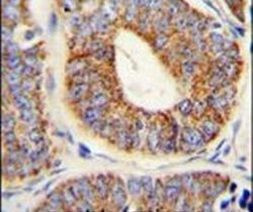 HDJ2 Antibody in Immunohistochemistry (IHC)