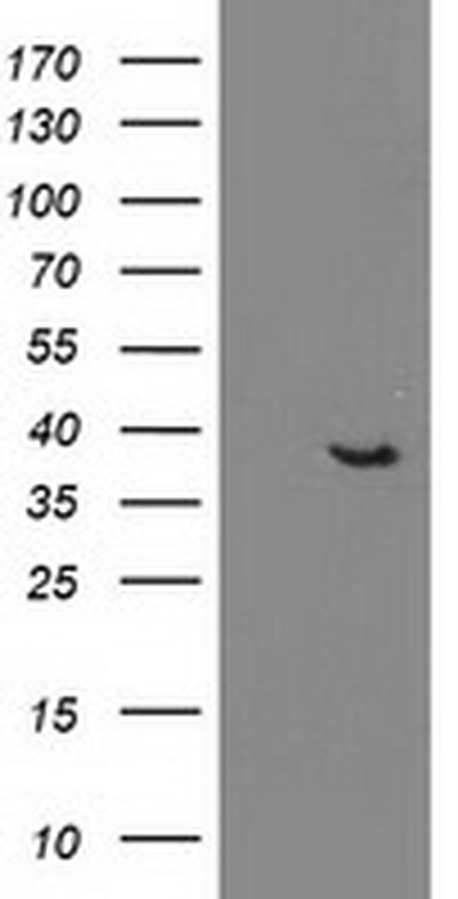 DNAJB1 Antibody in Western Blot (WB)