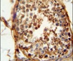 DNAJB13 Antibody in Immunohistochemistry (IHC)
