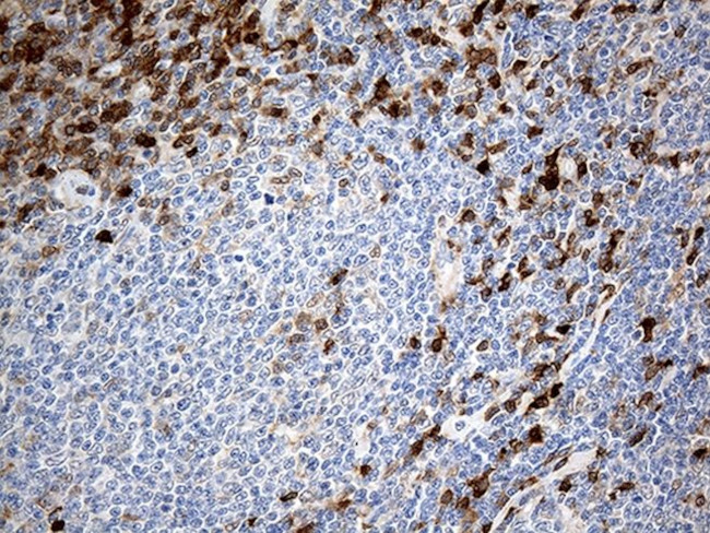 DNAJB5 Antibody in Immunohistochemistry (Paraffin) (IHC (P))