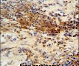 DNAJC11 Antibody in Immunohistochemistry (IHC)