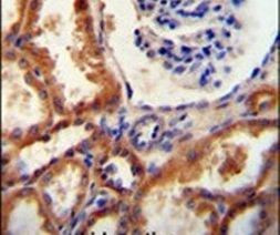 DNAJC22 Antibody in Immunohistochemistry (IHC)