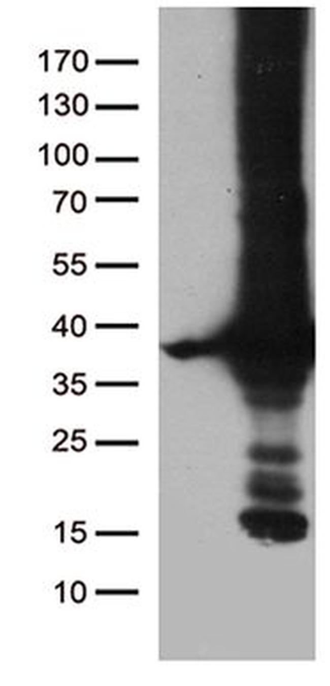 DNAJC27 Antibody in Western Blot (WB)