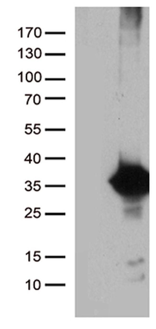 DNAJC27 Antibody in Western Blot (WB)