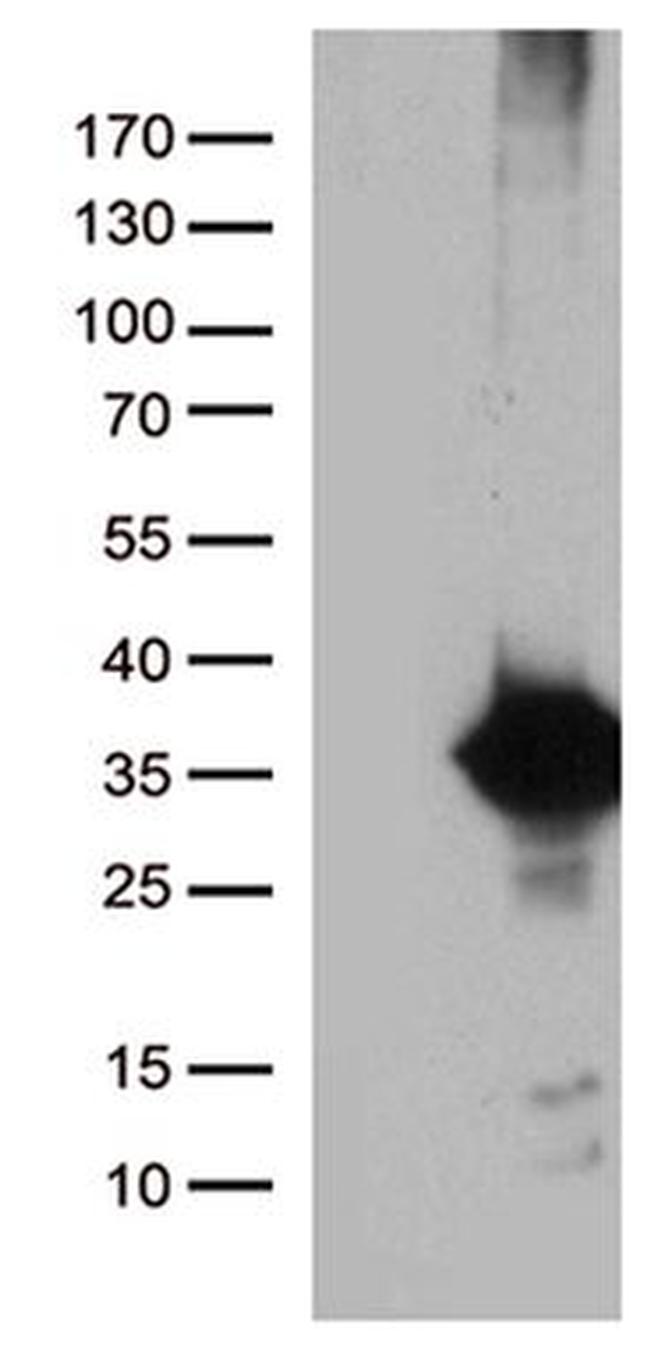DNAJC27 Antibody in Western Blot (WB)