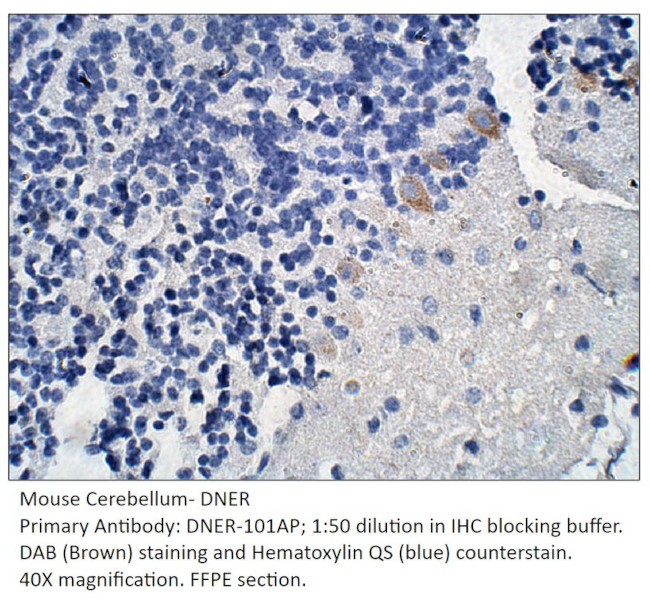 DNER Antibody in Immunohistochemistry (IHC)