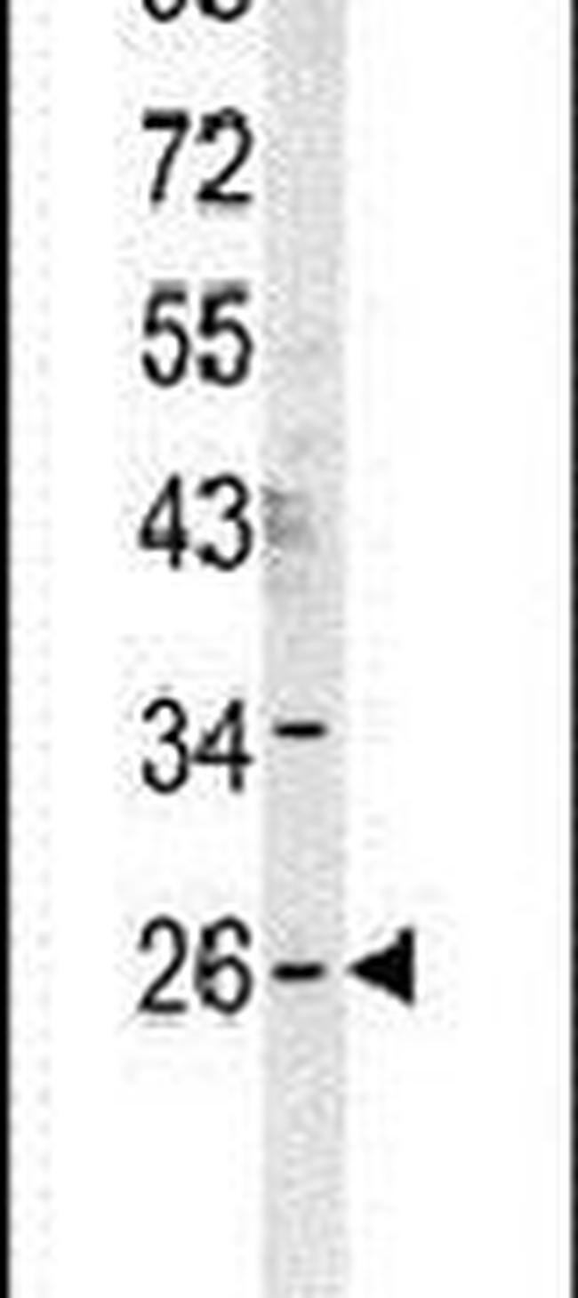 DNAJC8 Antibody in Western Blot (WB)