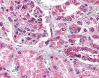 DNM1L Antibody in Immunohistochemistry (IHC)